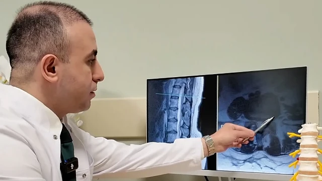 Bel Fıtığı Hakkında Uzman Görüşleri: Ameliyat En Son Çare